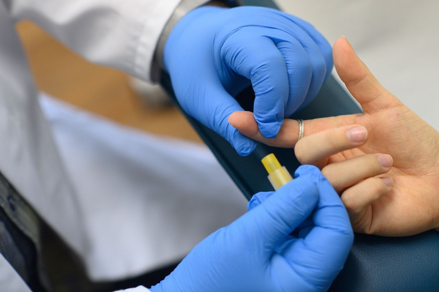 In einem Labor wird von einer Patientin Blut für einen HIV-Test entnommen.