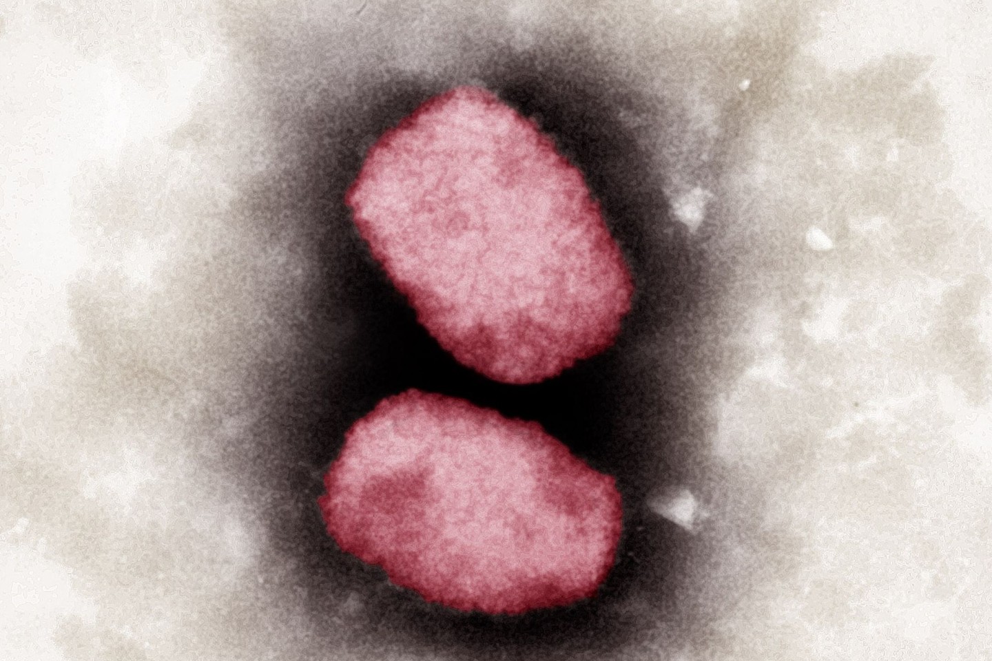 Eine Elektronenmikroskopische Aufnahme von Affenpocken-Viren.