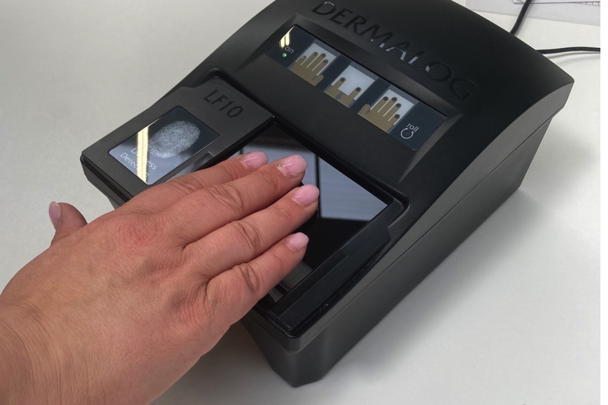 Fingerabdruckscanner