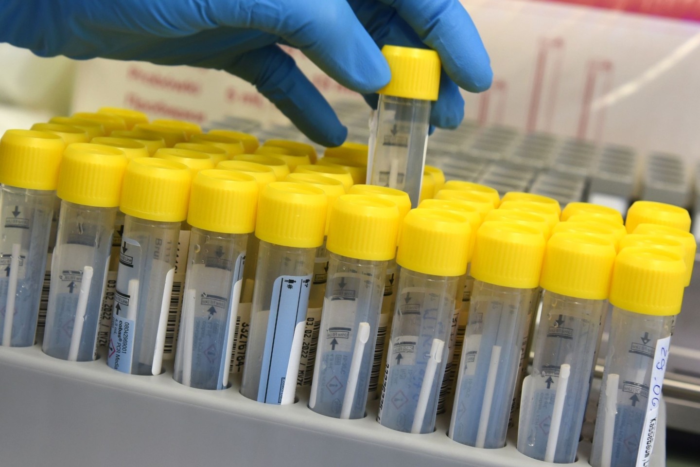 Eine medizinisch technische Assistentin bereitet in einem Labor die Bearbeitung von PCR-Tests vor.